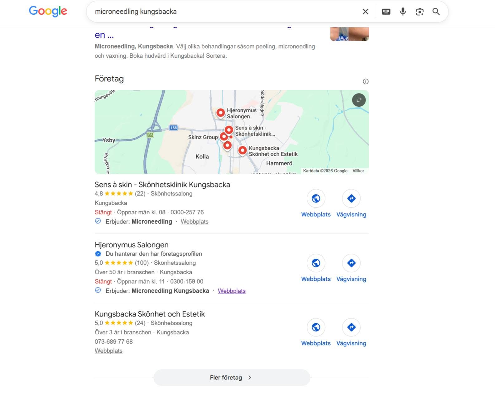 Google-sökning "microneedling kungsbacka" — placering #2